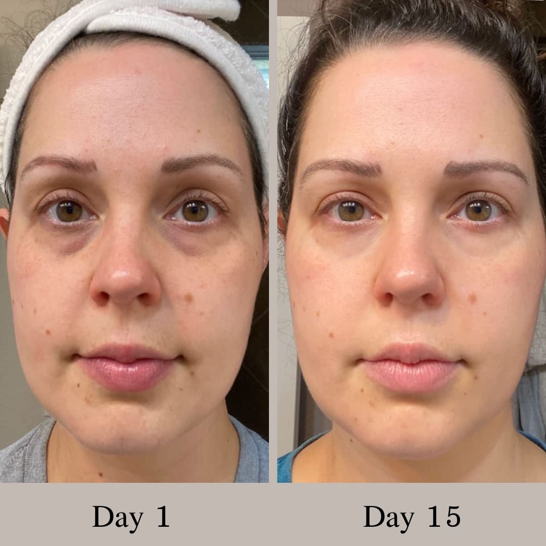 Lápiz regenerador para una mirada sin ojeras ni bolsas